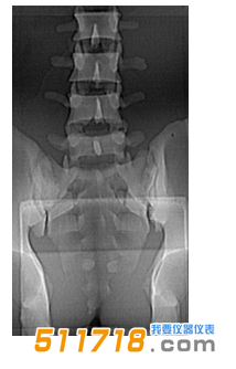 美國CIRS 034腰椎穿刺訓練模體1.png